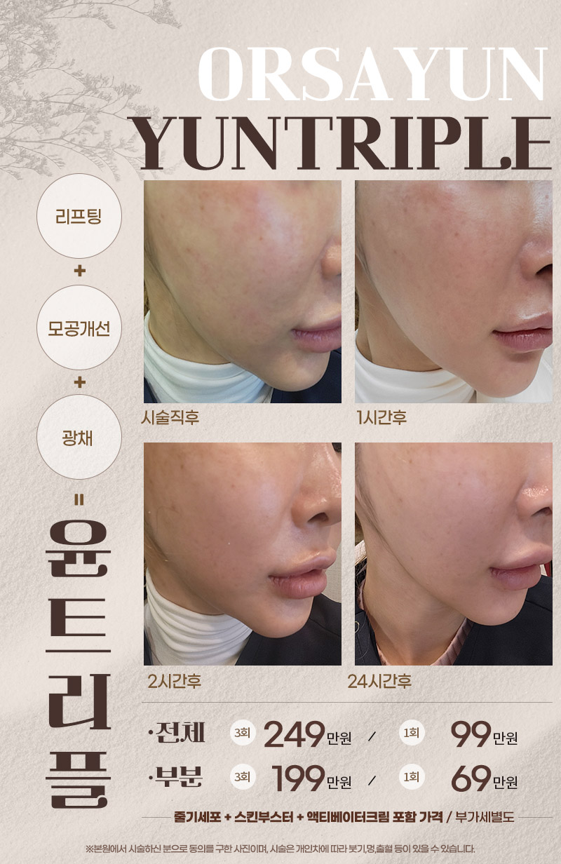 윤트리플리프팅